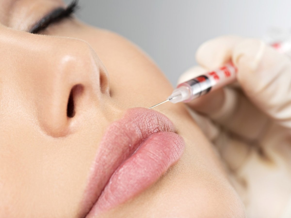Botox, Dysport or Xeomin Aftercare