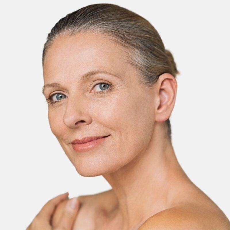 Collagen Induction Therapy - Pittsfield, MA