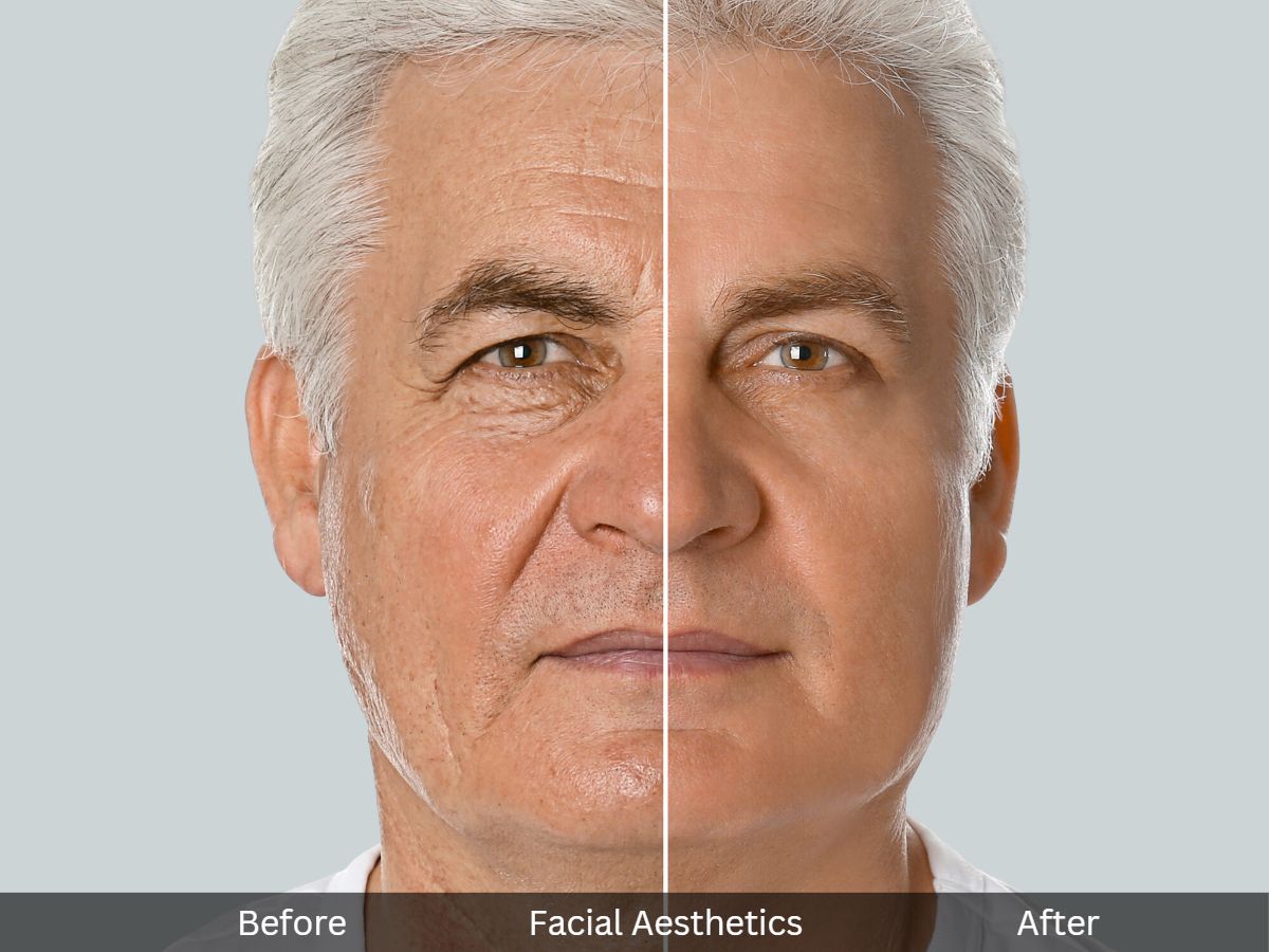 Facial Aesthetic Treatments for Men